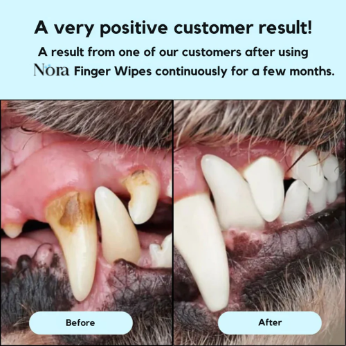 Nora™ Finger Wipes