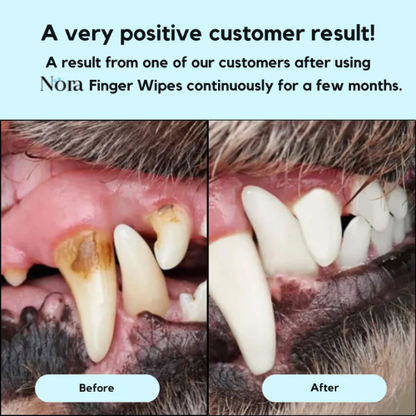 Nora™  Finger Wipes